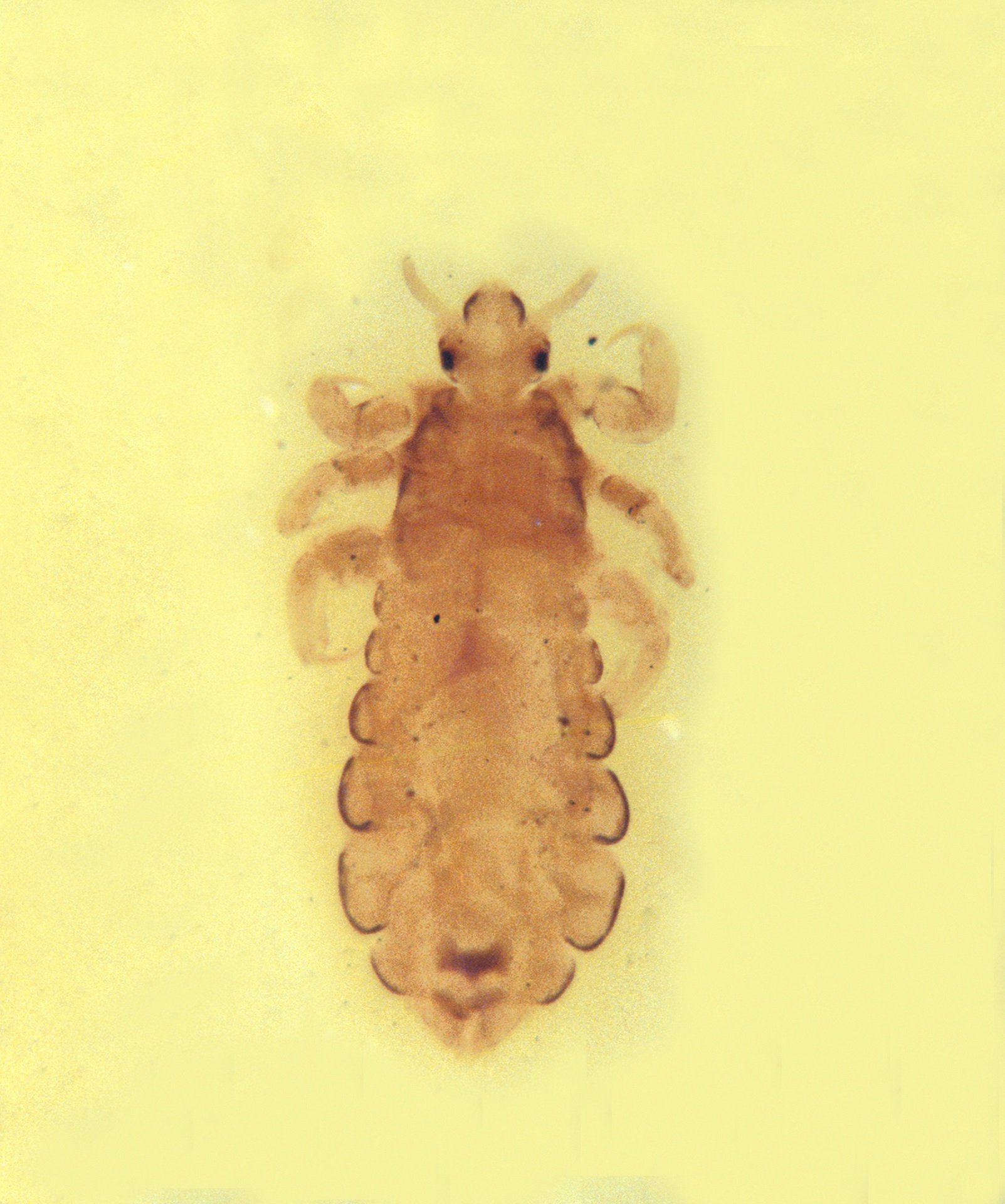 Pédiculose du cuir chevelu. Agent pathogène Base de données EFICATT